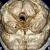 LM